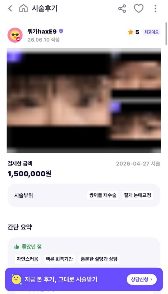 바비톡 사진 후기 캡처