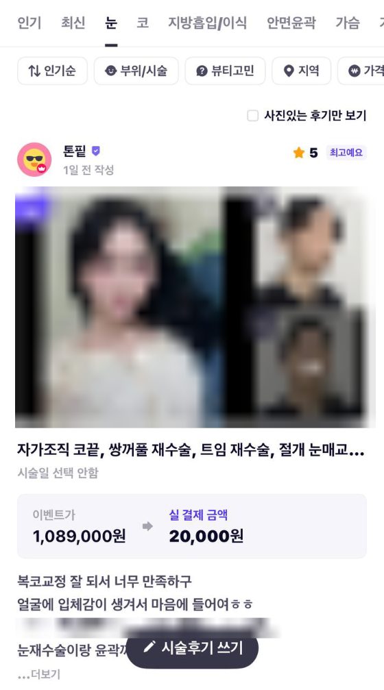 바비톡 시술후기 상위노출 캡처