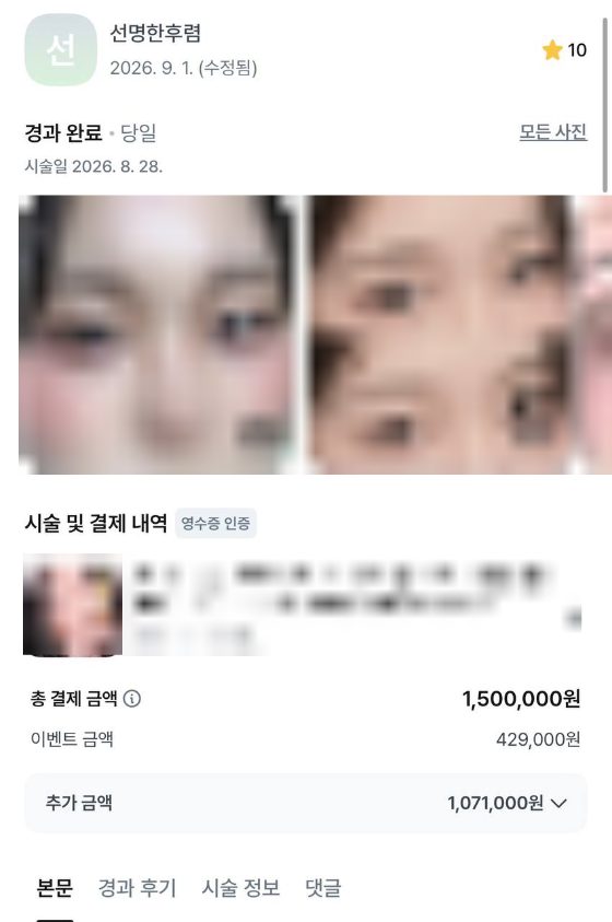 강남언니 이벤트 후기 캡처